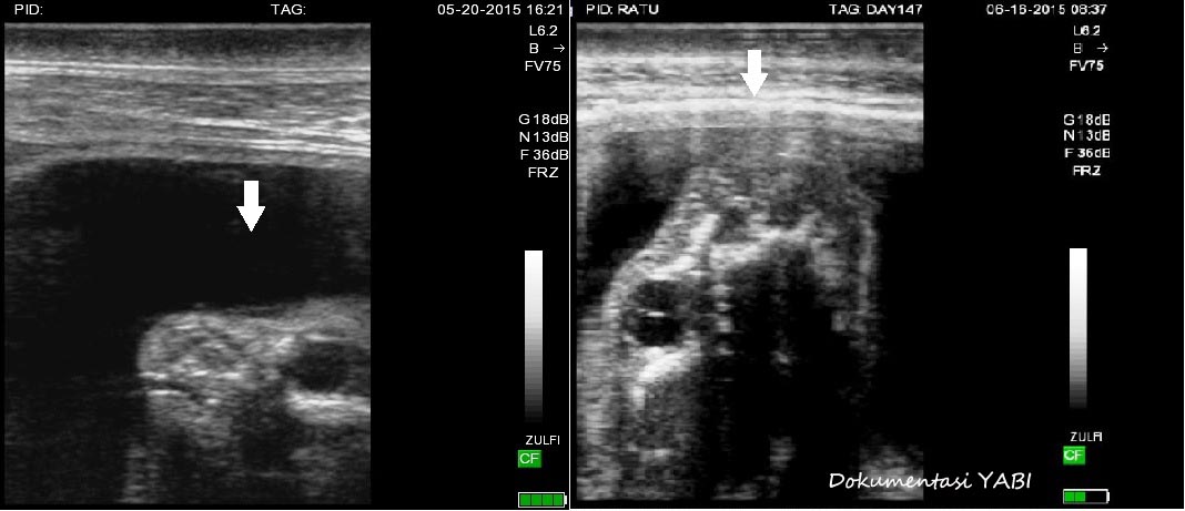 Gambar. (kiri): Kepala foetus pada usia kehamilan hari ke-117. (Kanan): Kepala foetus pada usia kehamilan hari ke 147.